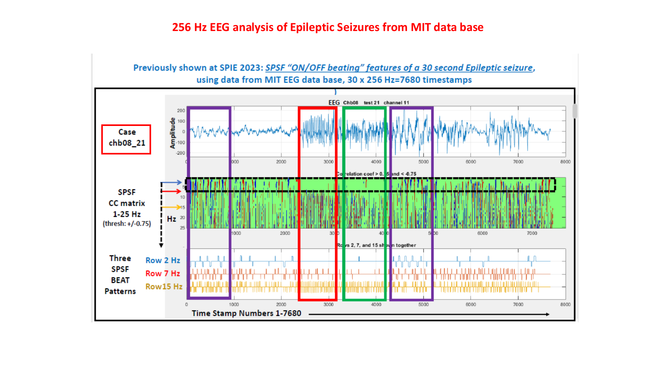 EEG seizure analysis slide with the blue 256 Hz sampling annotation and purple detection boxes around the red seizure box