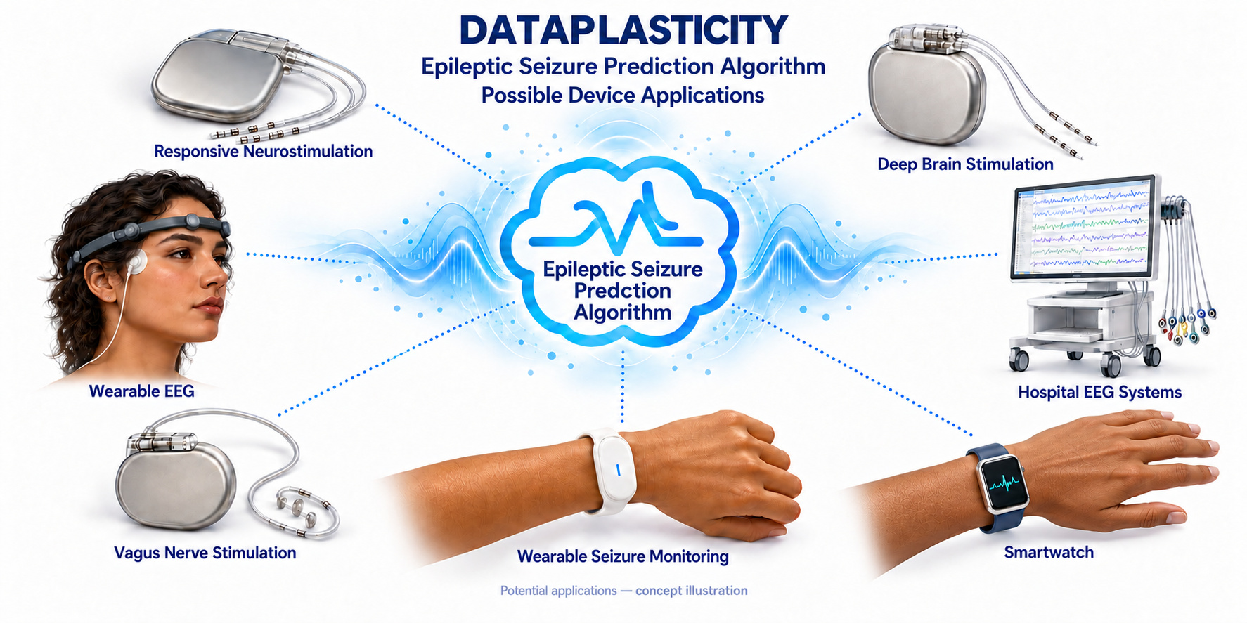 DATAPLASTICITY epileptic seizure prediction algorithm possible device applications: responsive neurostimulation, deep brain stimulation, vagus nerve stimulation, wearable EEG, hospital EEG systems, wearable seizure monitoring, and smartwatch. Potential applications, concept illustration.
